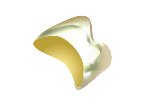金歯