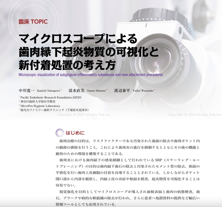 マイクロスコープによる歯肉縁下起炎物質の可視化と新付着処置の考え方