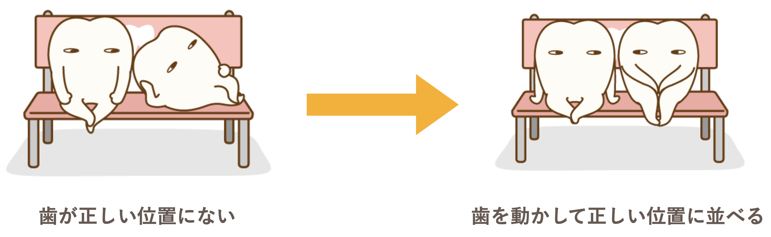 歯が正しい位置にない→歯を動かして正しい位置に並べる