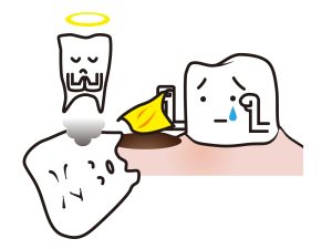 歯が抜けた
