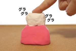 揺れてる歯