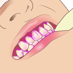 染め出し