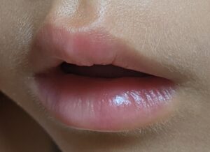口が開いている子供