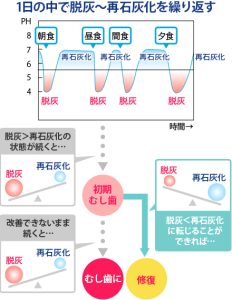 ステファンカーブ