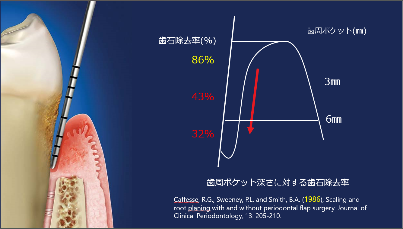 歯周ポケット深さによる歯石除去率