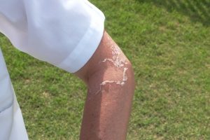 日焼けした腕