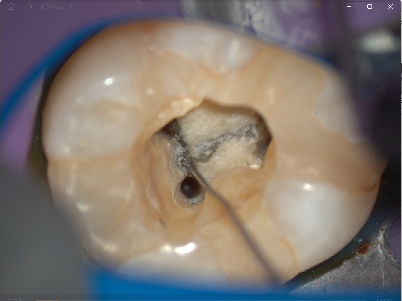 マイクロで録画した映像