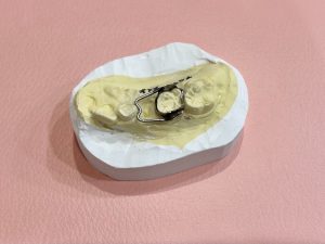 バンドループ