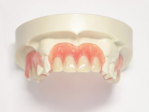 入れ歯