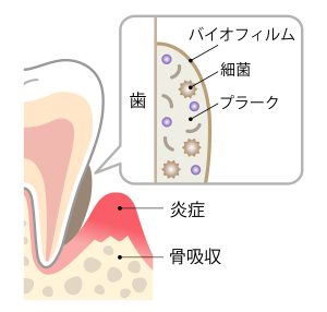 バイオフィルム